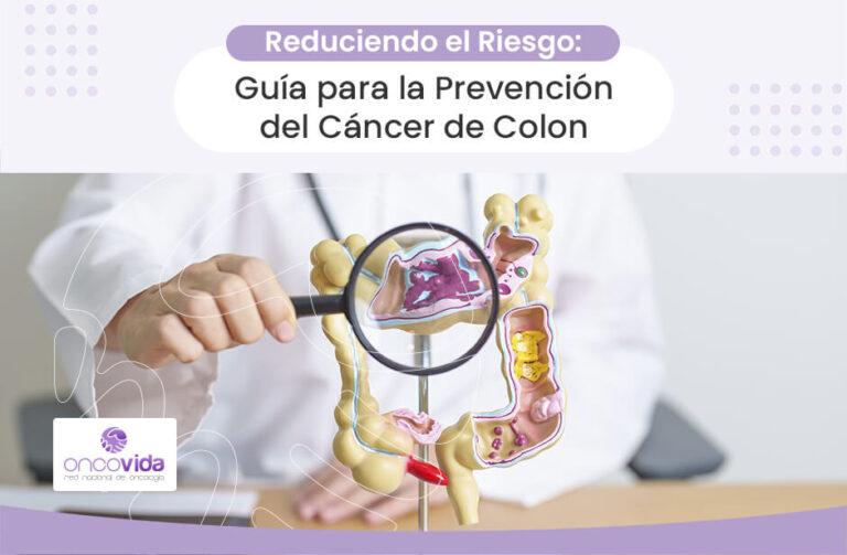 prevención, síntomas, diagnóstico y tratamiento sobre el cáncer de colon. Centro oncológico Oncovida en Providencia