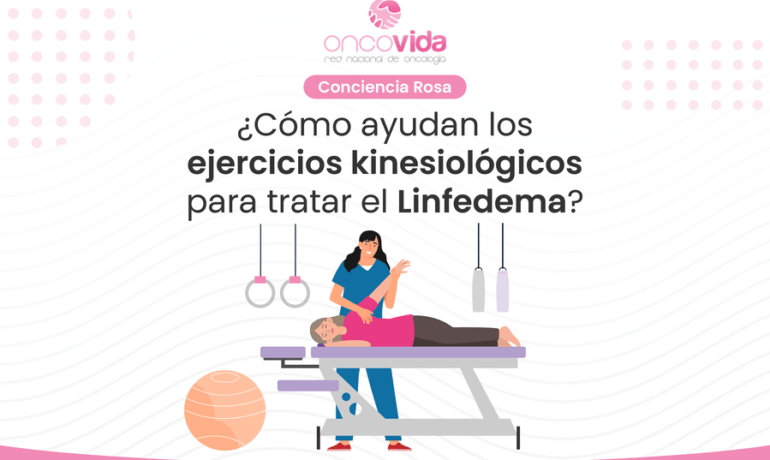 qué es el linfedema y ejercicios kinesiológicos