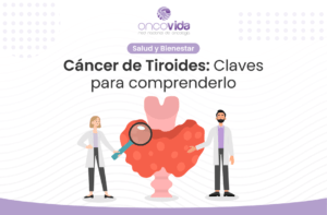 Aprende sobre el cáncer de tiroides prevención, factores de riesgo, tratamiento, ges