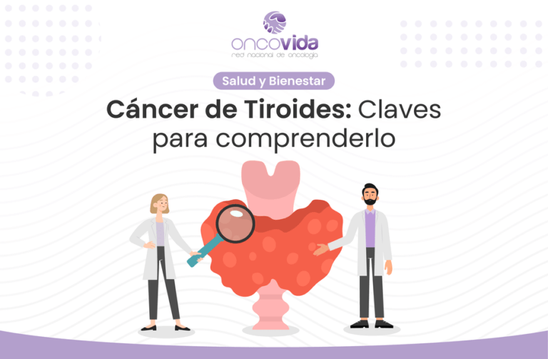 Aprende sobre el cáncer de tiroides prevención, factores de riesgo, tratamiento, ges