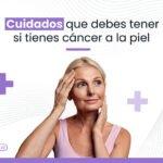 cuidados para pacientes con cancer de piel