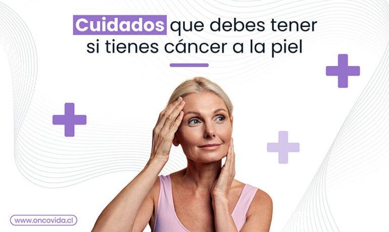 cuidados para pacientes con cancer de piel