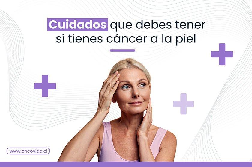 cuidados para pacientes con cancer de piel