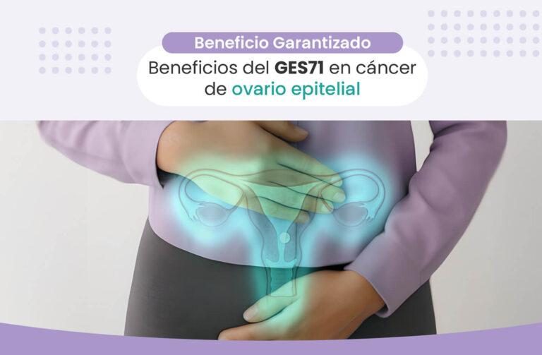 ges 71 cáncer de ovario