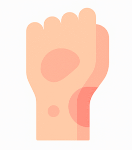 ícono de enrojecimiento de piel