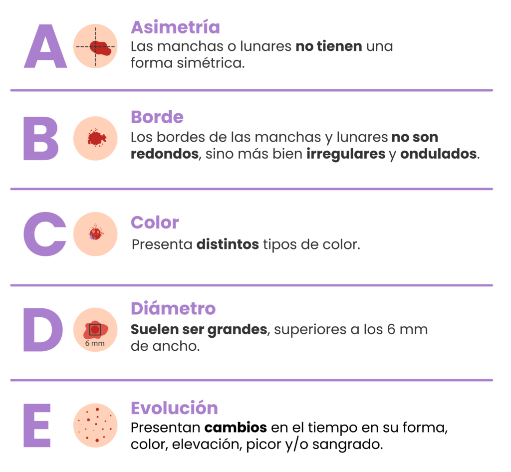 cómo identificar el melanoma ABCDE