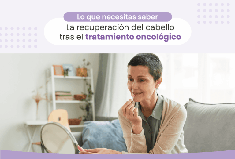 cómo cuidar el pelo nuevo despues de quimioterapia. Centro oncológico Oncovida Providencia
