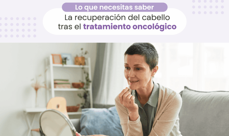 cómo cuidar el pelo nuevo despues de quimioterapia. Centro oncológico Oncovida Providencia