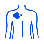 estudios clínicos oncovida melanoma